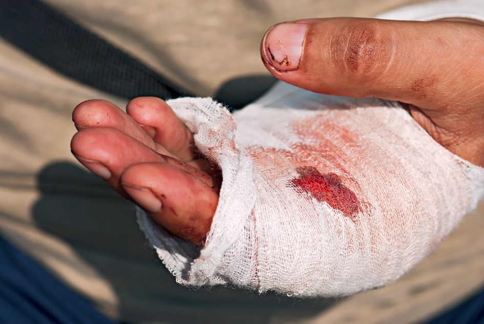 Workplace Safety Gloves and Masks hand injury